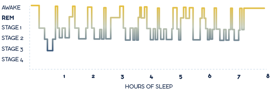 graph depicting what fragmented sleep looks like